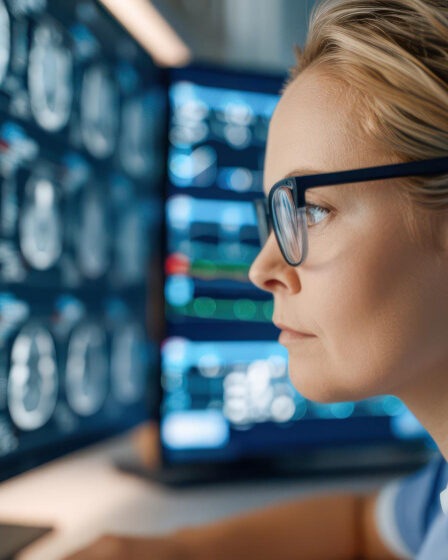 Imagerie Cérébrale